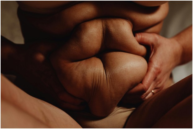 Financing Your Sono Bello Procedure