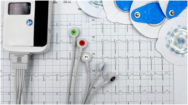 What is an EKG Test and Why Is It Important?