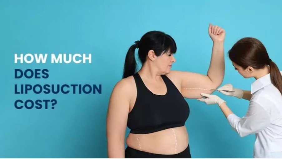 How Much Does Liposuction Cost