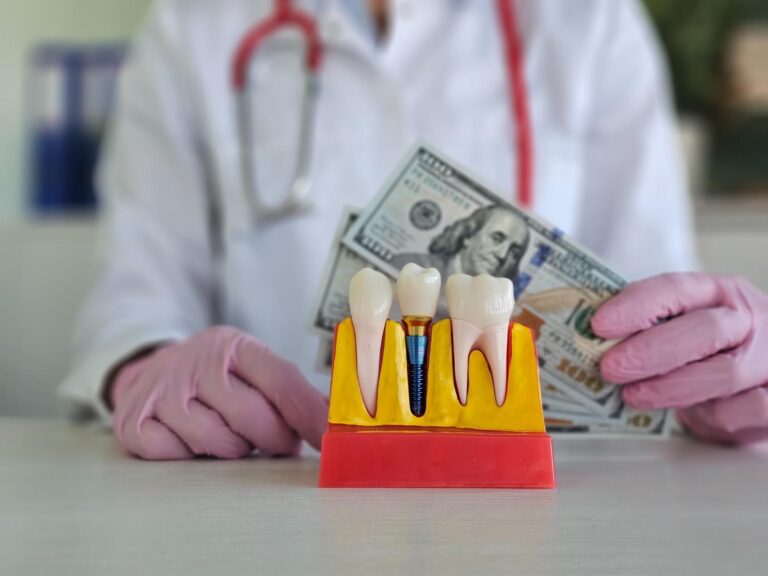 How Much Does a Full Set of Teeth Implants Cost?