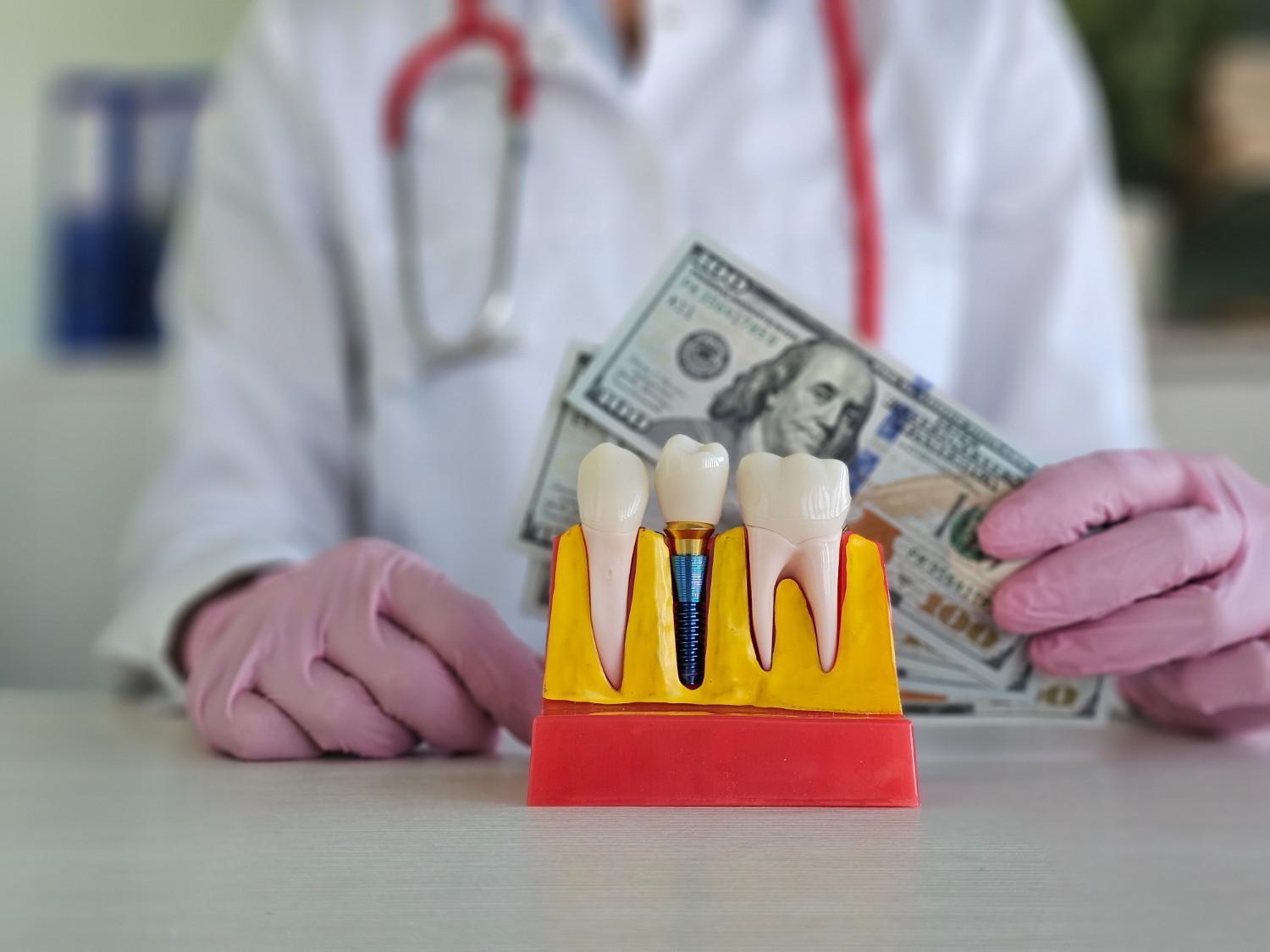 How Much Does a Full Set of Teeth Implants Cost