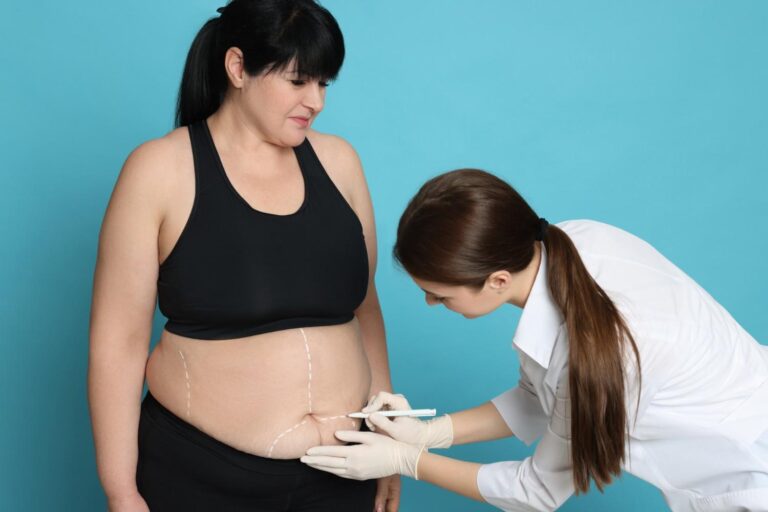 How Much Does a Tummy Tuck Cost? Real-Life Price Breakdown