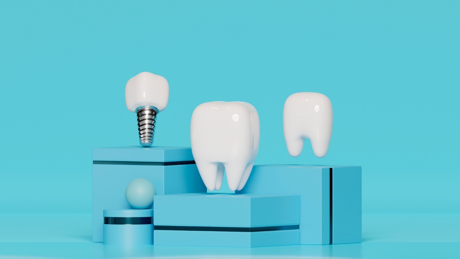 Smart Ways to Make Full Teeth Implants Totally Worth It