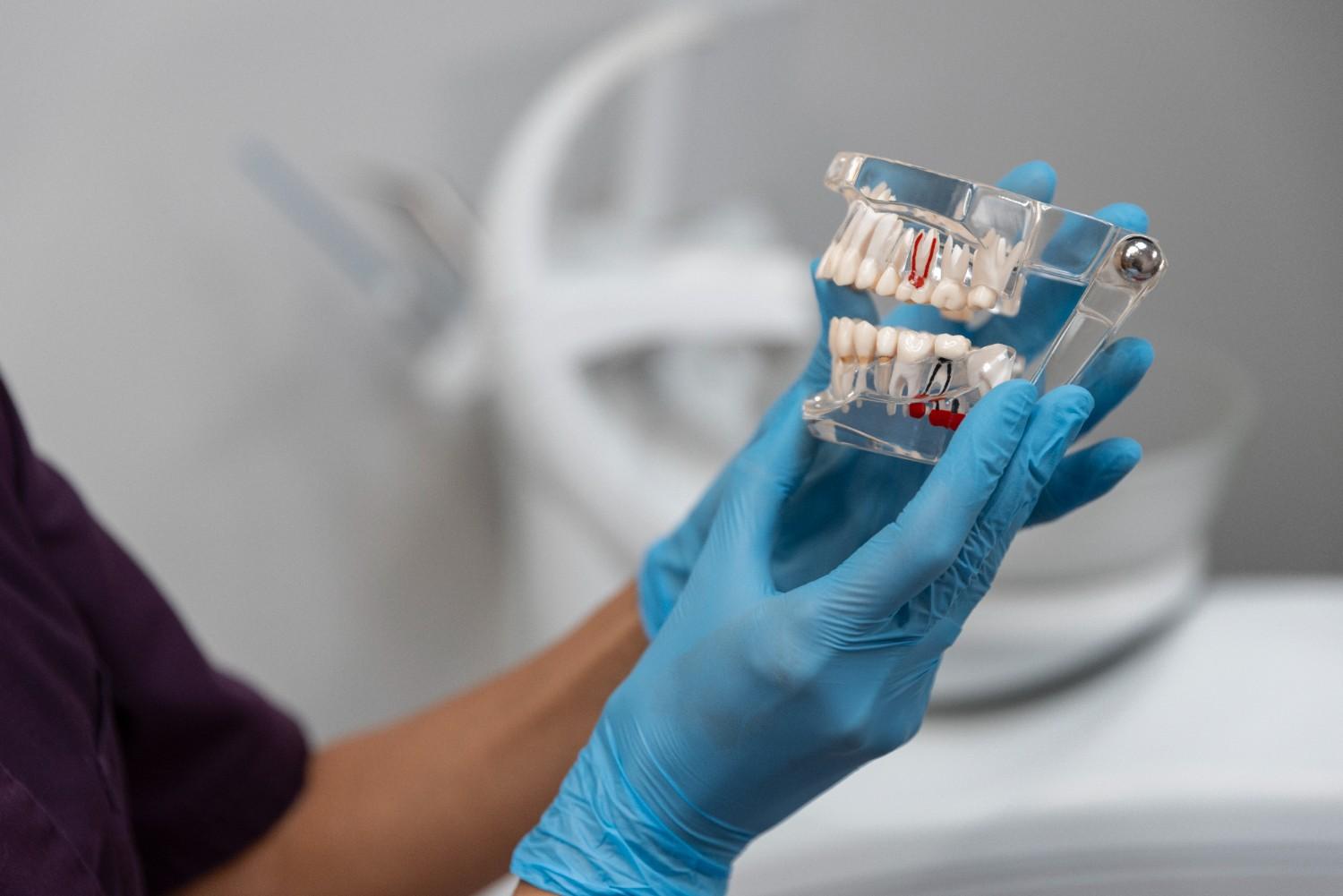 What If I Can’t Afford Full Teeth Implants